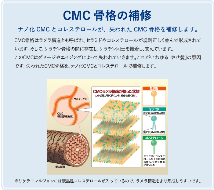 CMC骨格の補修